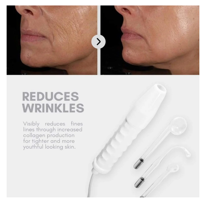 Mirqelle™ High Frequency Therapy | Clear Acne and Prevent Future Breakouts