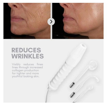 Mirqelle™ High Frequency Therapy | Clear Acne and Prevent Future Breakouts
