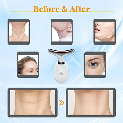 Mirqelle™ Anti Wrinkle Facial Massager Neck Face