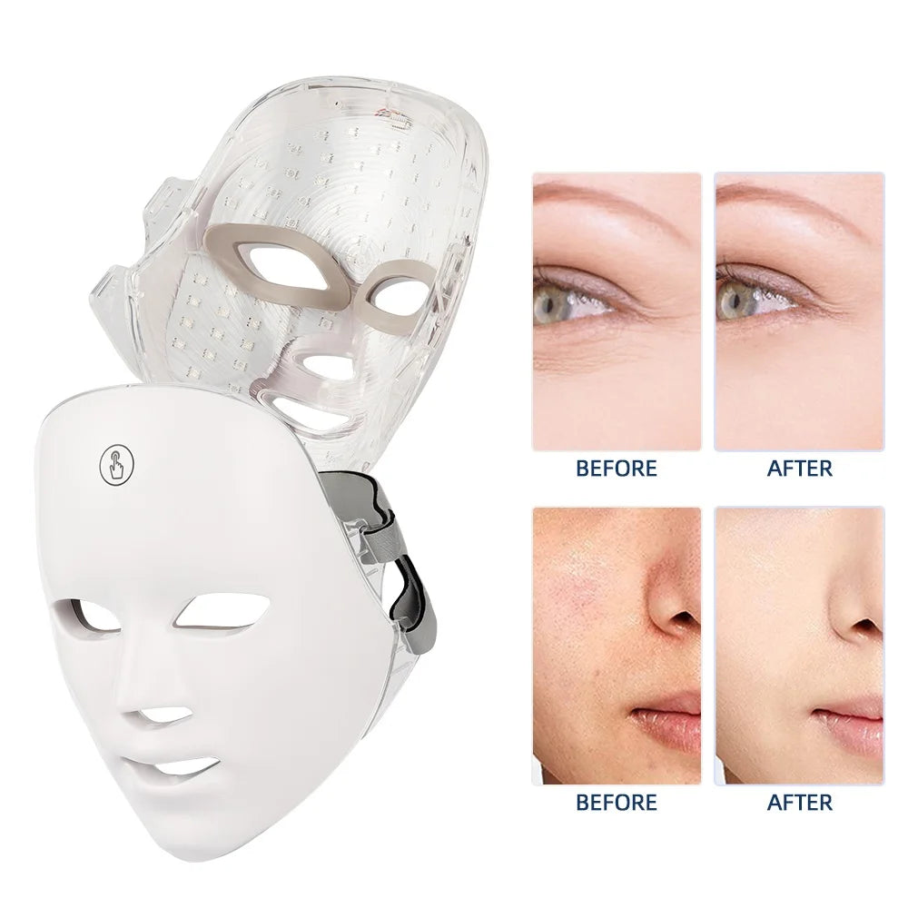 Mirqelle™ Photon Therapy Beauty Mask